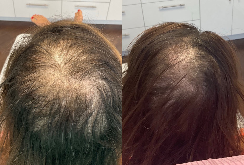 EXCLUSIVE EVENT PRICING: PRP - THORNHILL SKIN CLINIC