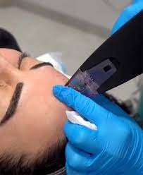 EXCLUSIVE EVENT PRICING:  MORPHEOUS8 - THORNHILL SKIN CLINIC