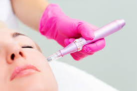 BOGO MICRONEEDLING - THORNHILL SKIN CLINIC