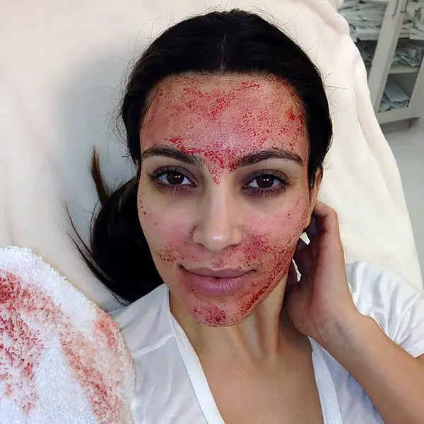 BOGO MICRONEEDLING - THORNHILL SKIN CLINIC